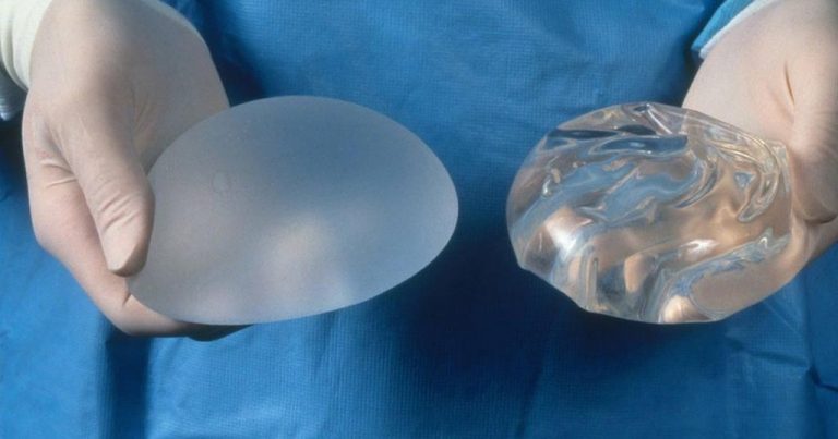 Global Breast Implants breast implants before and after